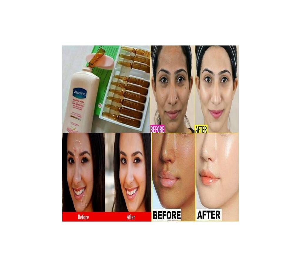 V-C Vitamin C whiting Injections