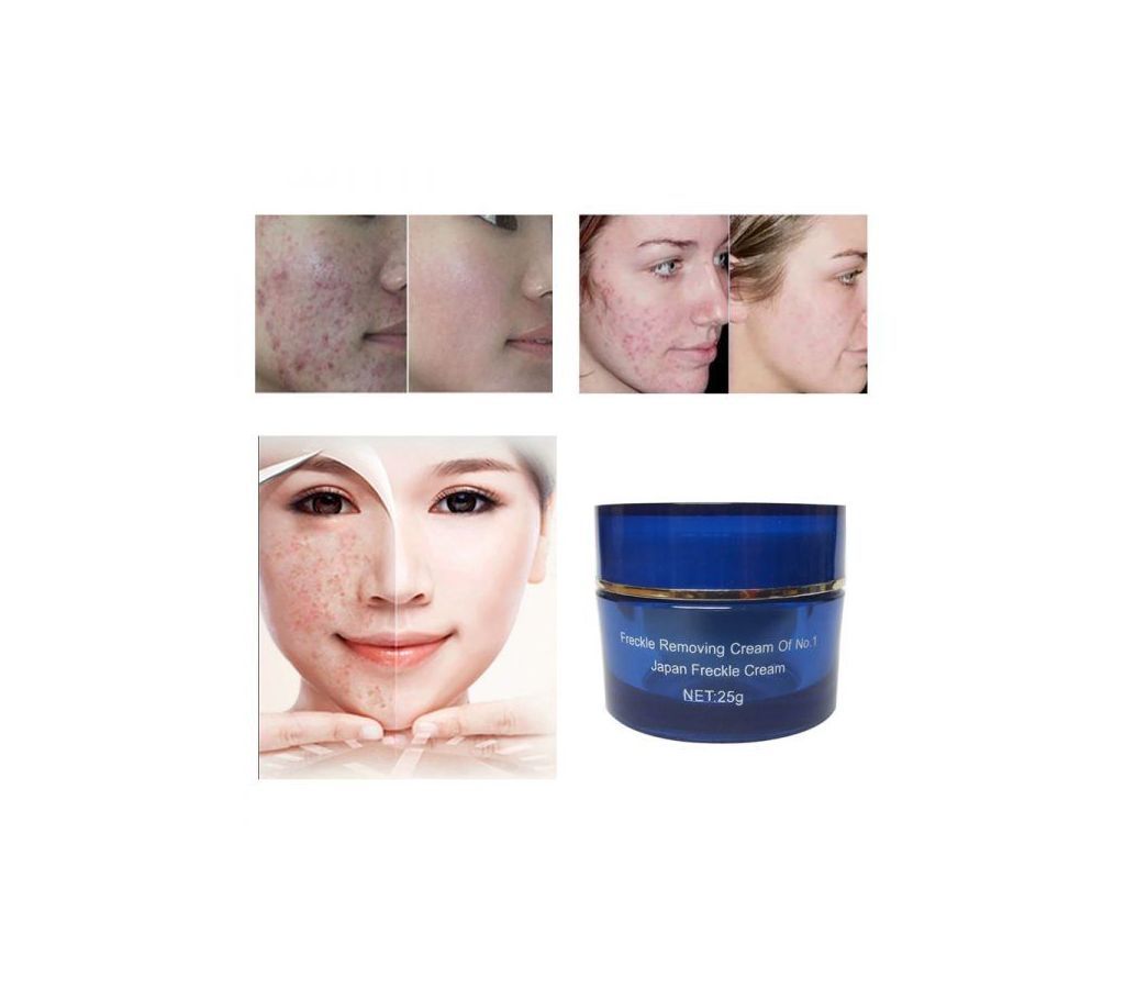 Specialized Anti-Freckle -Acne, Scar and spot Removing cream
