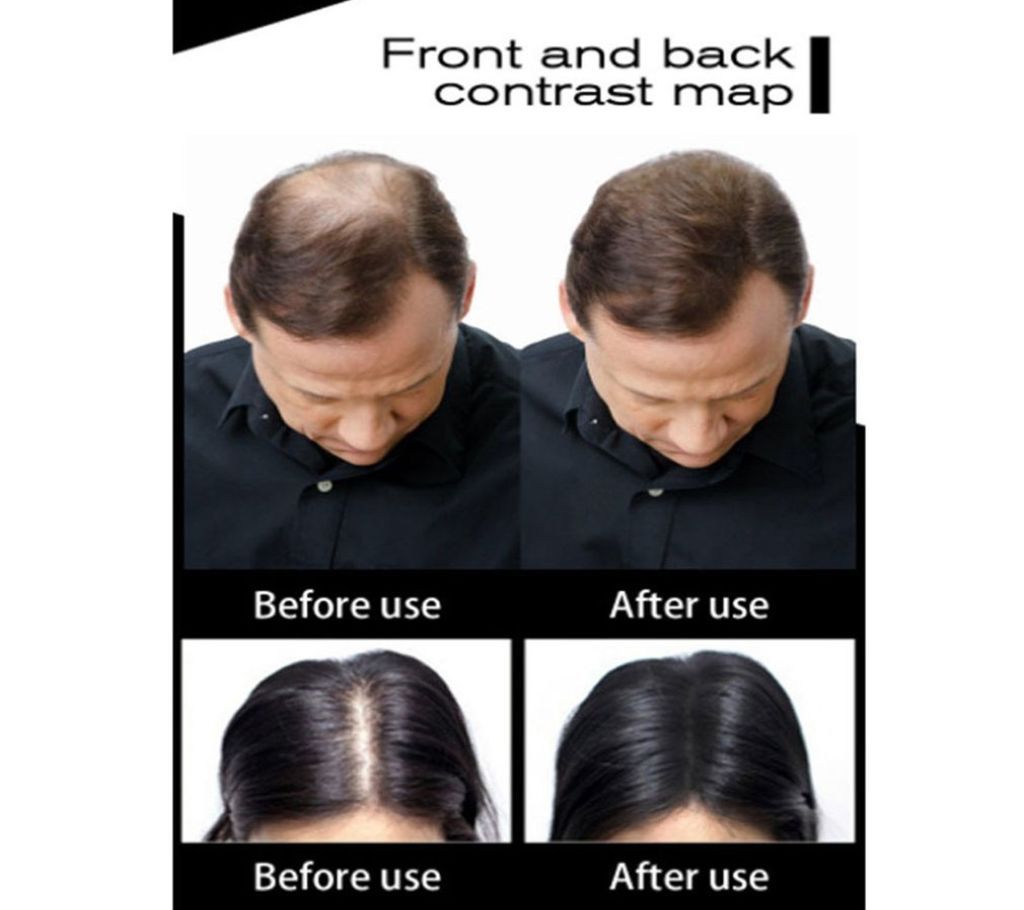 Toppik Hair Building Fibers Loss Extension Growth----dark brown