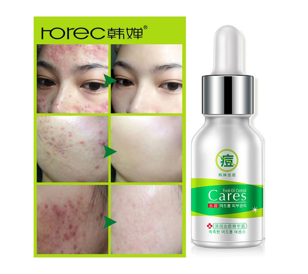 Acne Treatment Serum -China