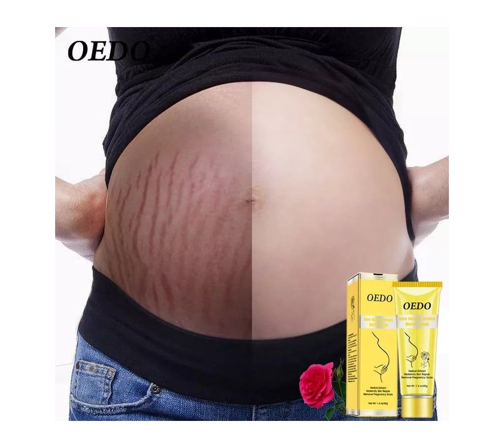 Pregnancy Scars Removing Cream